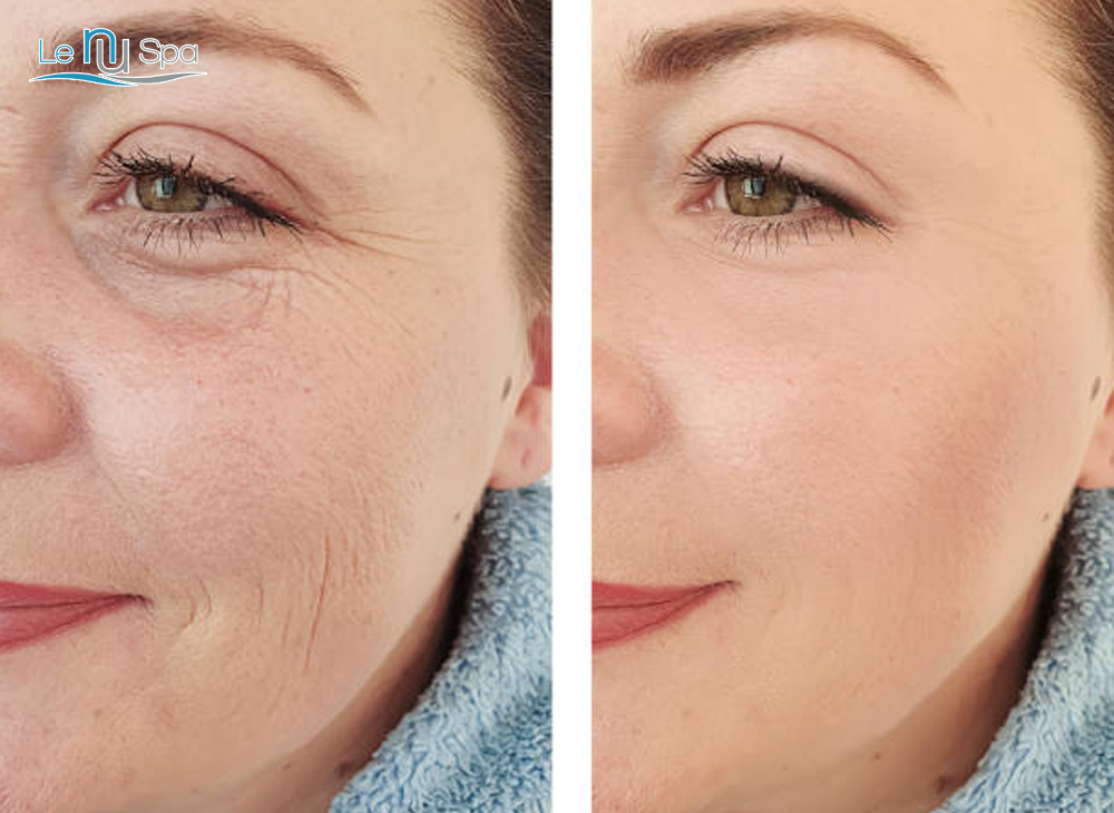 SQT Anti-Aging