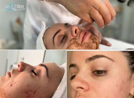Add-On SQT Anti-Aging - 10 sessions