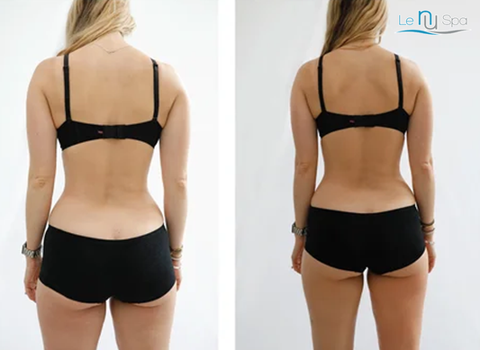 CRYOSKIN Toning - 5-Pack