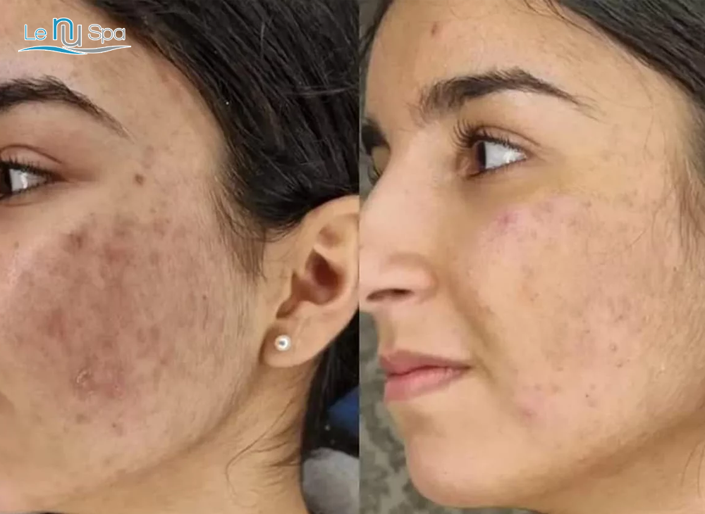 Discount SQT Facial - Model for training