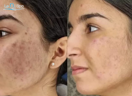 Discount SQT Facial - Model for training