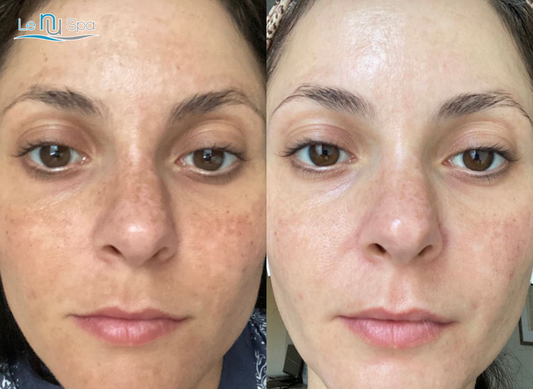 SQT Anti-Aging- 10 Sessions