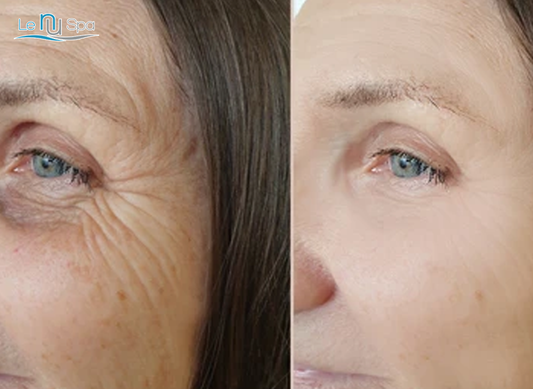 SQT Anti-Aging- 4 Sessions