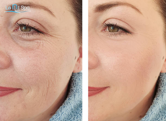 SQT Anti-Aging