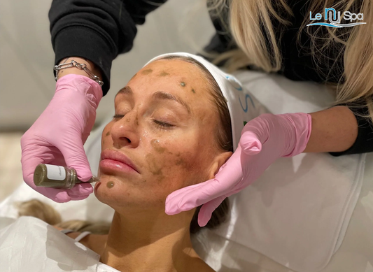 SQT Biomicroneedling - 4 sessions